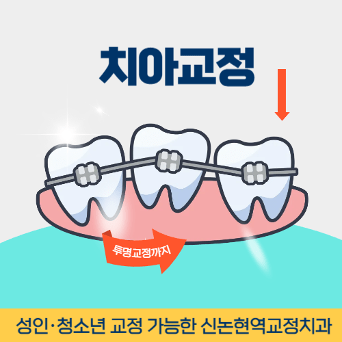 대구치과 대구광역시 치과 치아교정