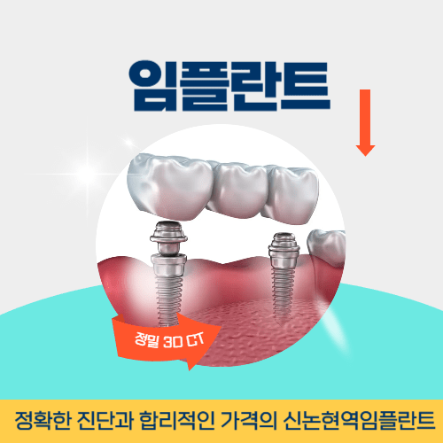 대구치과 대구광역시 치과 임플란트