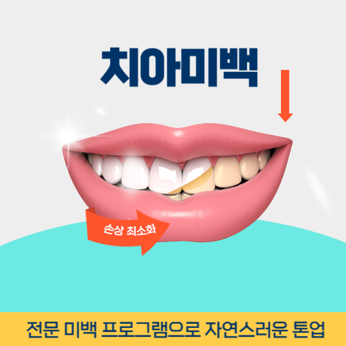 대구치과 대구광역시 치과 치아미백