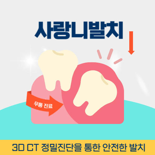 대구치과 대구광역시 치과 사랑니 발치